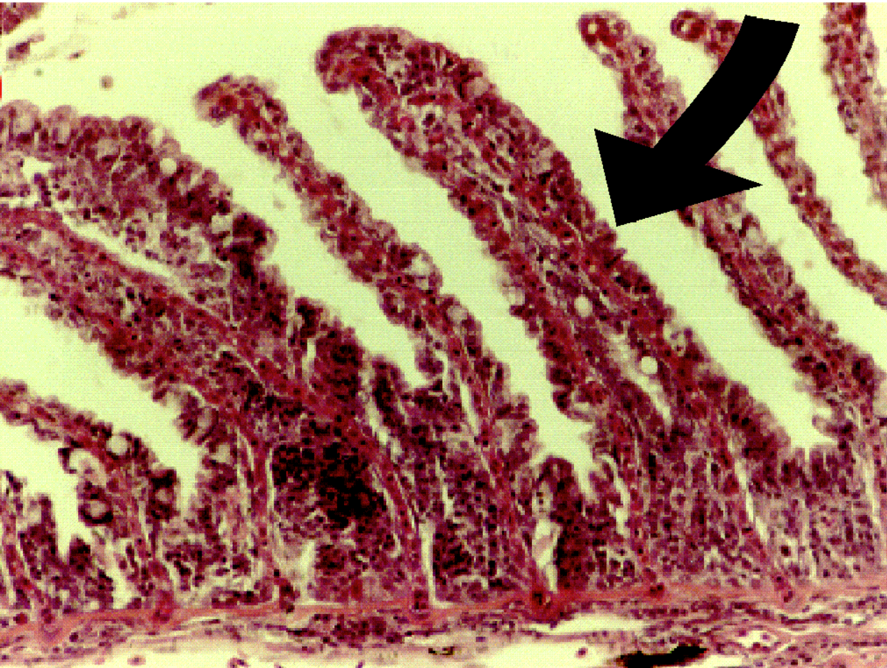 <ul><li><p><span style="font-family: "Century Gothic";"><span>increase in # of cells in a tissue or organ</span></span></p><ul><li><p><span style="font-family: "Century Gothic";"><span>organ increases in size by increasing number of cells</span></span></p></li><li><p><span style="font-family: "Century Gothic";"><span>skin + gills might thicken due to inflammation</span></span></p></li></ul></li></ul><p></p>