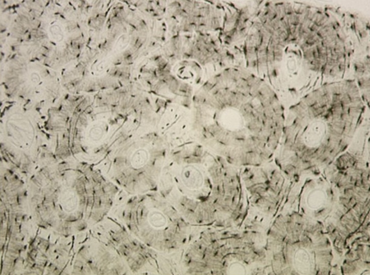 <p>Bone tissue </p>