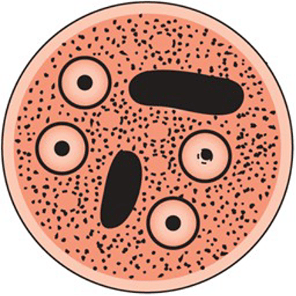 <p>This amoeboid protozoan is the __________ stage used to survive in the environment.</p>