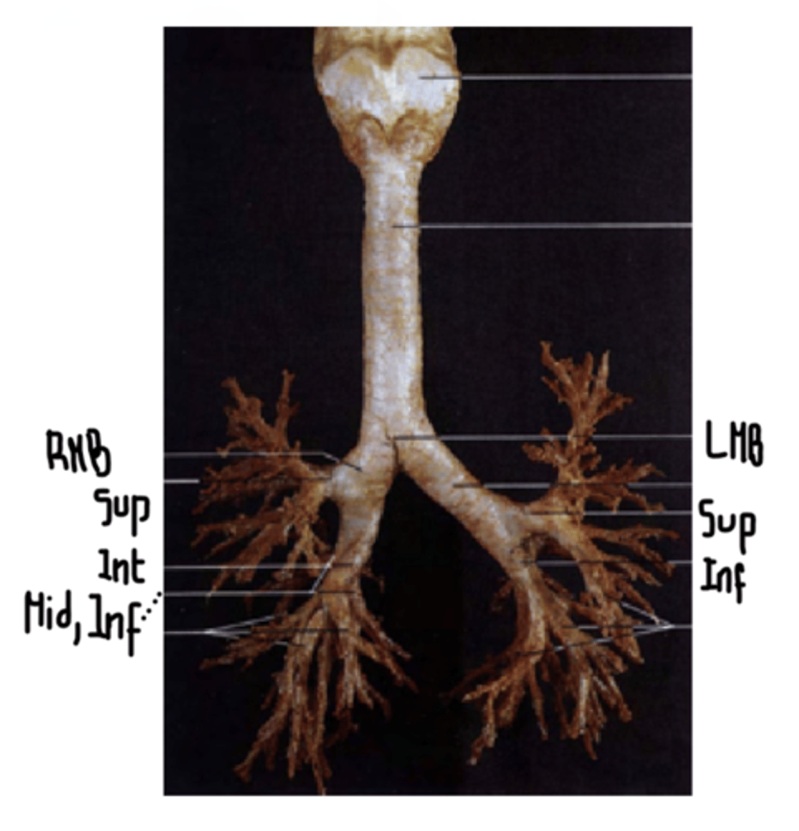 <p>. 2 main bronchi</p><p>. Left bronchus</p><p>. Right bronchus</p><p>. Secondary lobar bronchi</p><p>.2 on the left</p><p>.3 on the right</p><p>. Segmental lobar bronchi</p><p>. 8 segmental on the left</p><p>. 10 segmental on the right</p>