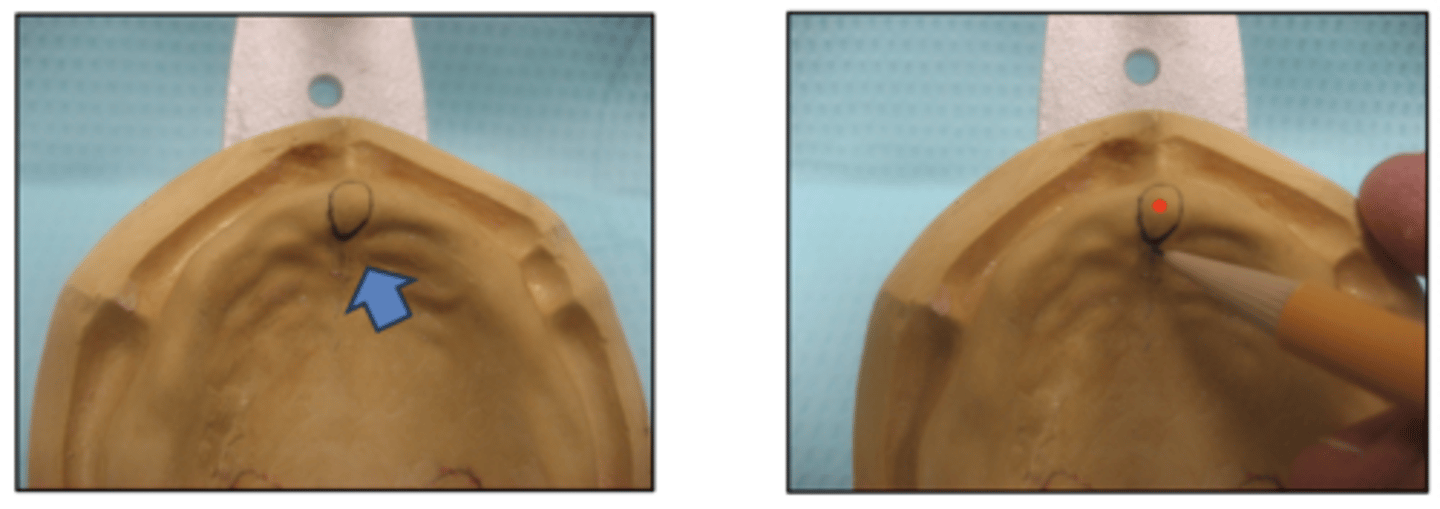 <p>The incisive papilla is marked on the maxillary final cast to position which teeth?</p>