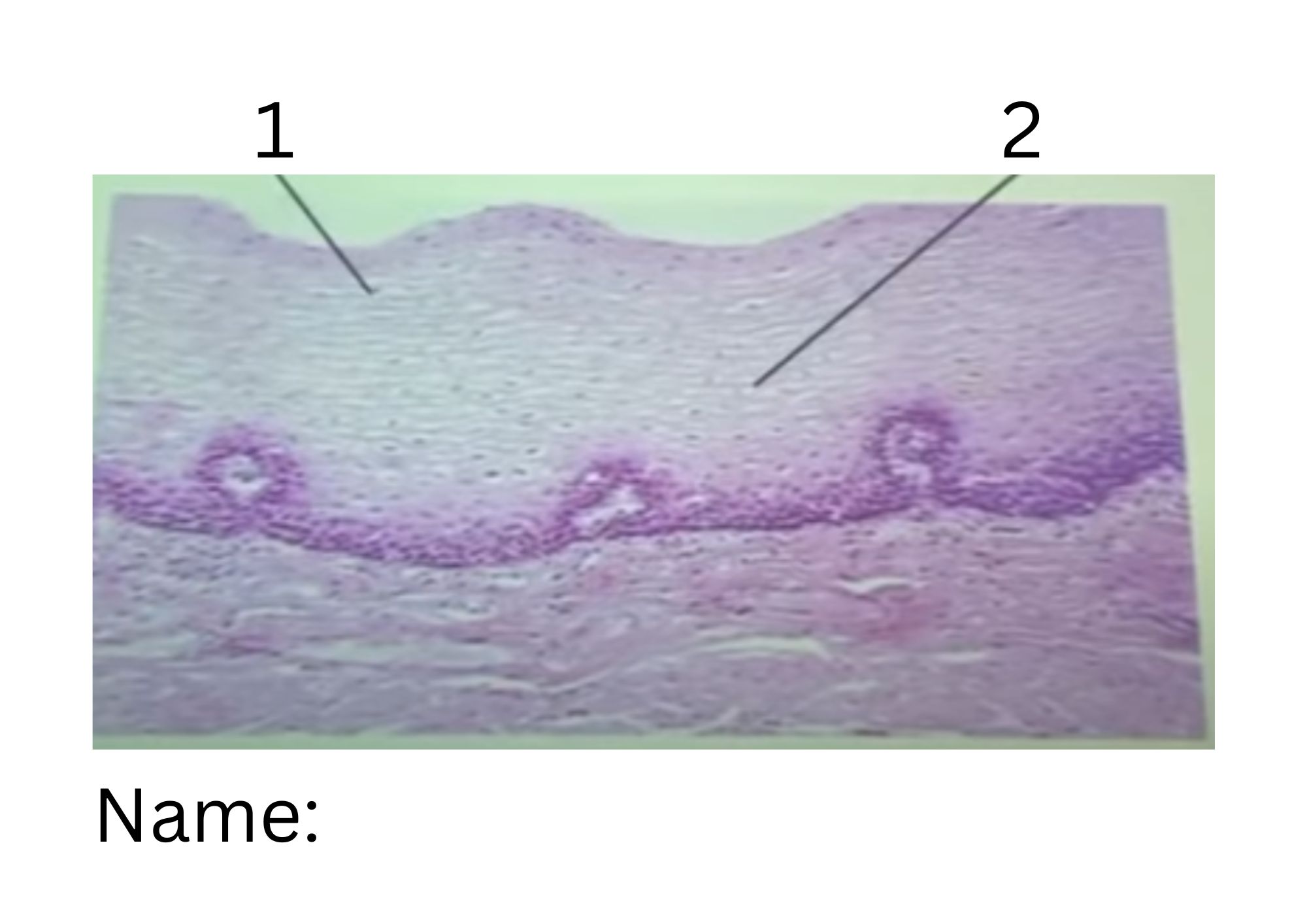 term image