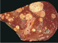 <p>Describa a qué corresponde la siguiente imagen:</p>