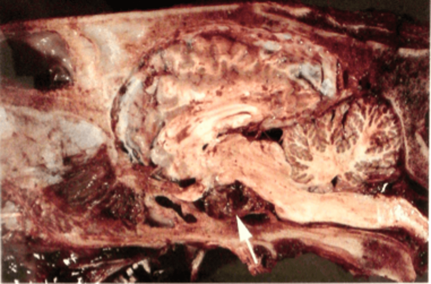 <p>Hovede fra hest, hvad er den patoanatomiske diagnose? Se pilen</p>