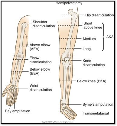 <p><strong>Amputation (Cause / S&amp;S / Diagnostics / Goals / Types)</strong></p>