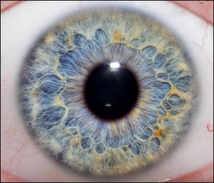 <p>the color part of the eye; made of muscle that contracts/relaxes to control the size of the people allowing light to enter the eye</p>