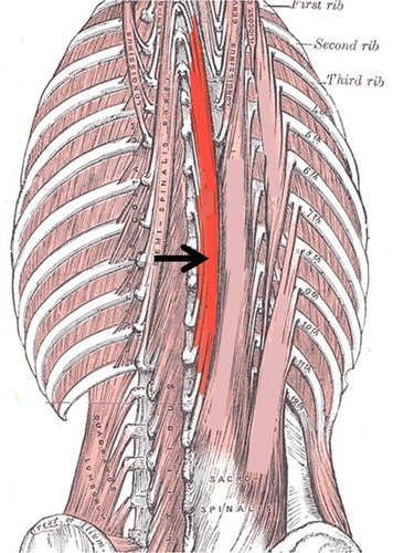<p>most medial</p>