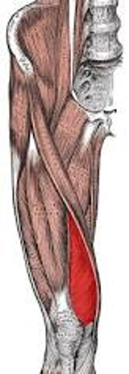 <p>medial side of quad, fibers run diagonally</p>