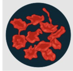 <p>The number of NPS is higher outside the cell compared to inside, causing the cell to shrink (as fluid rushes out to equalize). </p>
