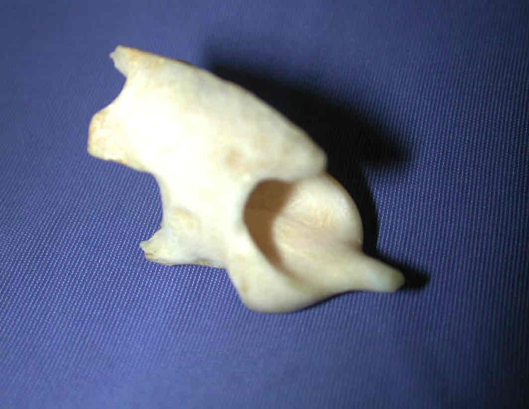 <p>What vertebra is this? How can you tell?</p>