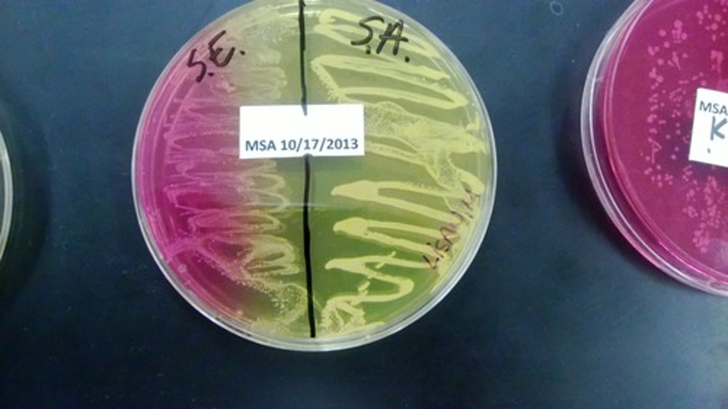 <p>mannitol- some organism ferment producing acid</p><p>phenol red- pH indicator (yellow at Ph 6.8; red at pH 7)</p>