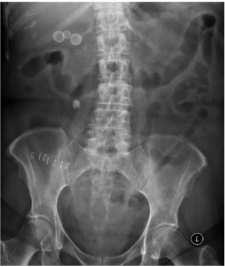 <p>What is this and what type of scan </p>