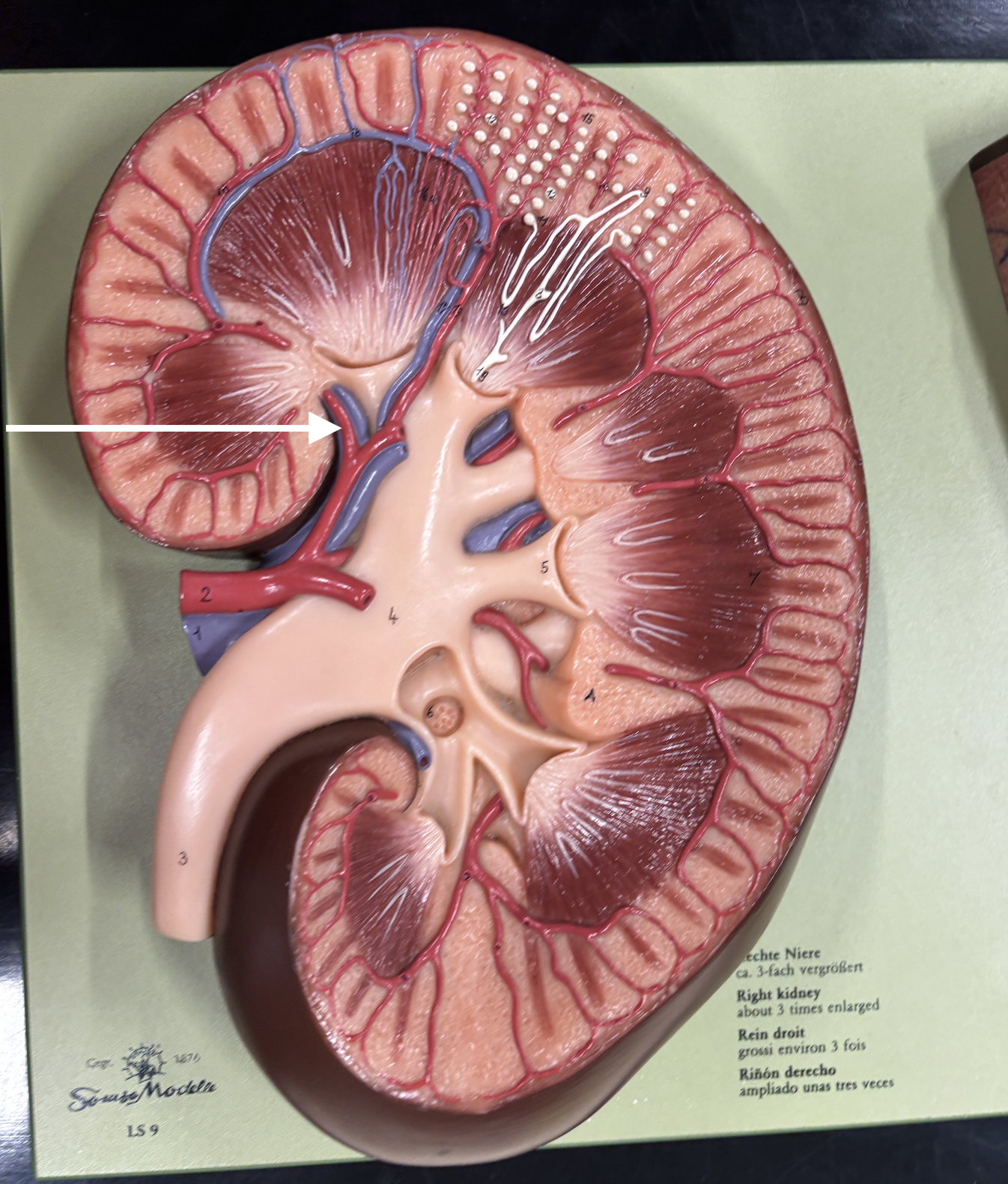 <p>what structure is the arrow pointing to? *artery*</p>