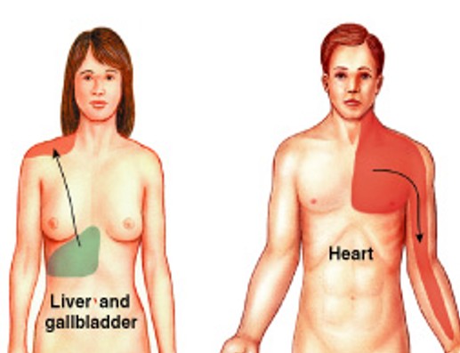 <p>Which pain type in anterolateral pathway is:</p><ul><li><p>Individual feels pain in specific part of body surface</p></li></ul><p></p>