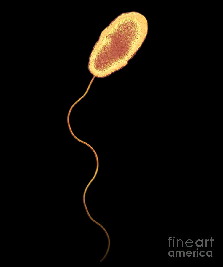 <p><span style="font-family: Georgia, serif">Are Pseudomonas </span>motile?</p>