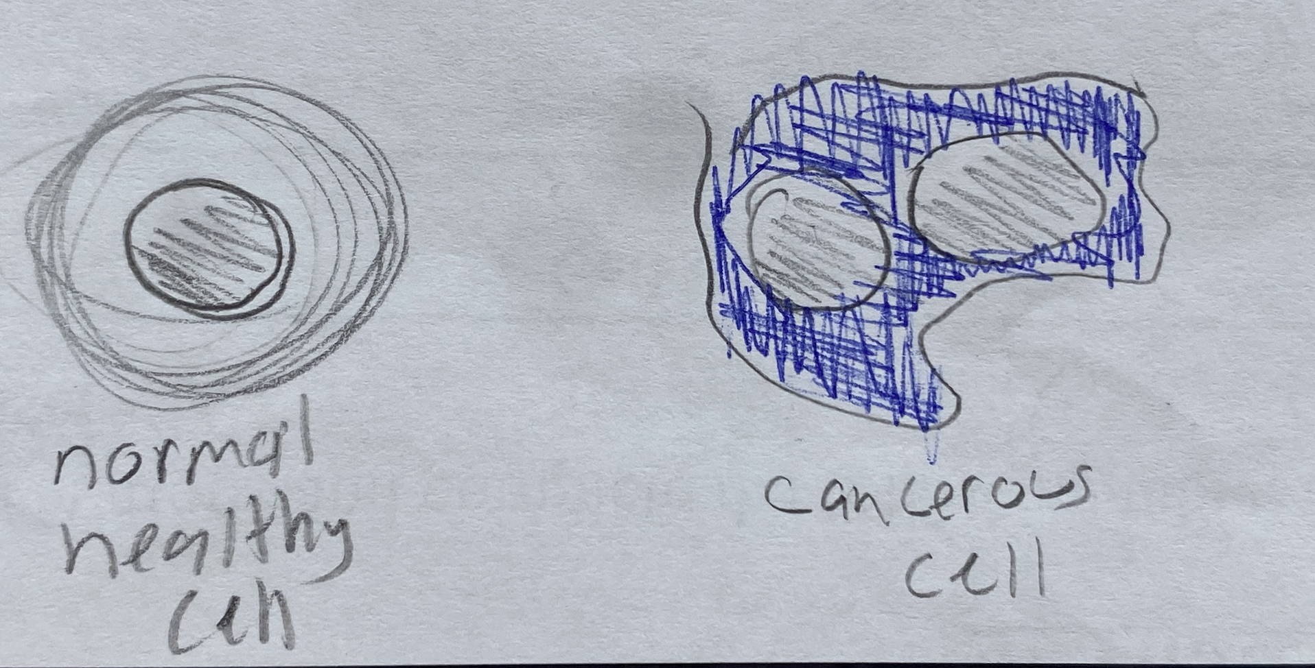 <p>normal cells: large cytoplasm, single nucleus and nucleolus</p><p>thick chromatin</p><p></p><p>cancer cell: small cytoplasm, many nuclei and nucleoli (bigger)</p><p>thin chromatin</p><p></p>