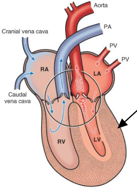 <ol><li><p>Stenotic valve restricts outflow of blood from LV→Aorta</p></li><li><p>Pressure overload of LV</p></li><li><p>LV concentric hypertrophy</p><ol><li><p>Arrhythmias and sudden cardiac death (if <u>severe</u> enough)</p></li><li><p>Congestive Left Heart Failure</p></li></ol></li></ol><p></p>