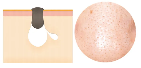 <p>to block or become blocked</p>