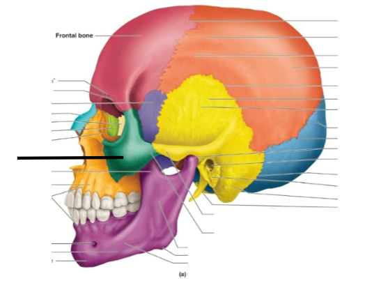 term image