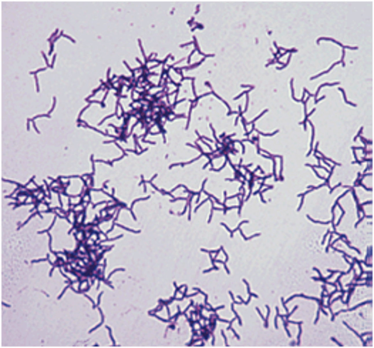 <p>-gram (+)</p><p>-filamentous-shaped</p><p>-<strong>anaerobic</strong></p>
