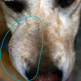 <p>Fibrosarcoma</p>