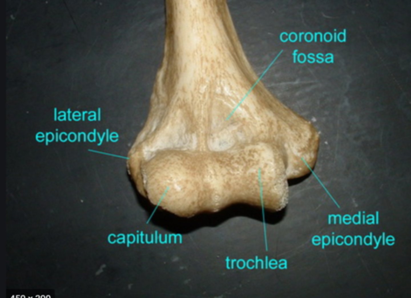 <p>-capitulum (cap that sits on radius)</p><p>-trochlea (where the ulna interacts)</p>