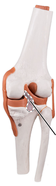 <p>What ligament is shown here?</p>