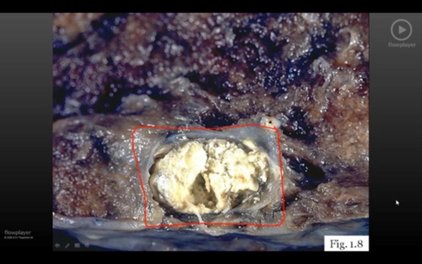 <p>ID gross path again</p>