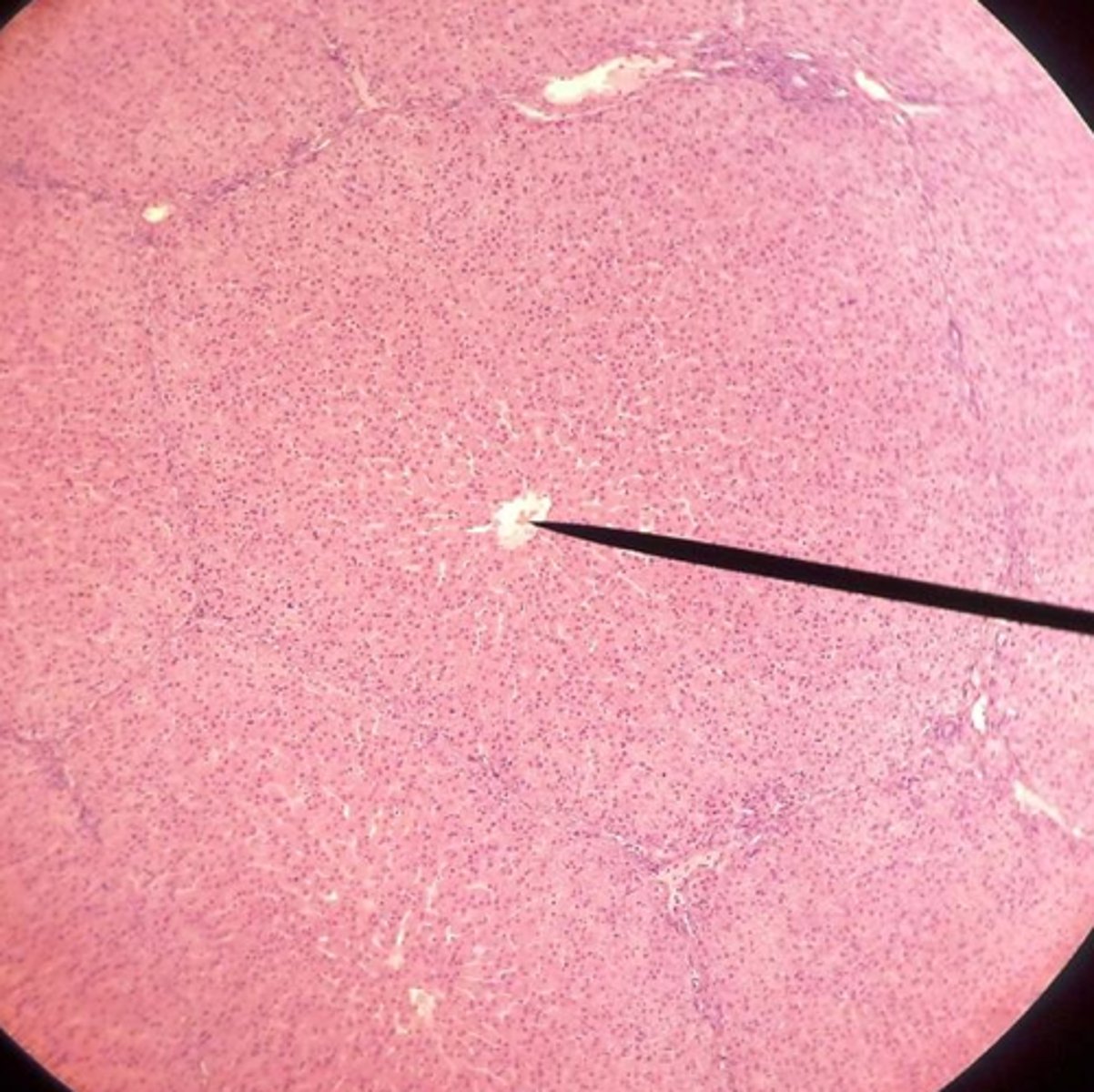 <p>vein that receives blood from hepatic sinusoids</p>