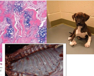 <p>What is this condition and explain its pathogenesis. Describe the main gross and histo features. </p>