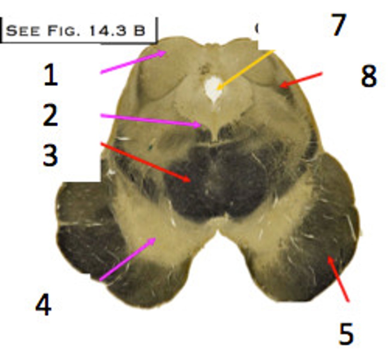 <p>lighter area around hole</p>