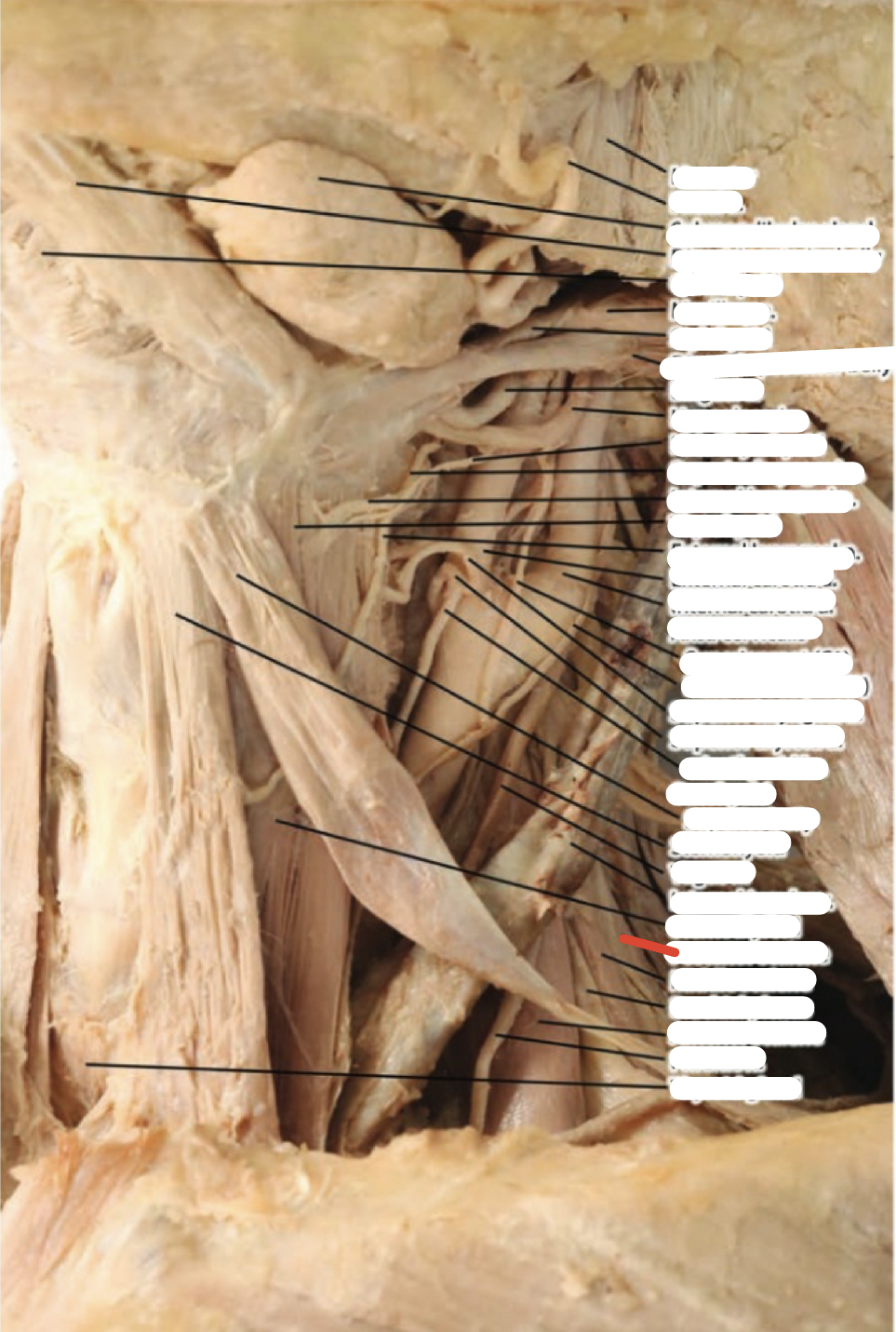 Identify the structure (red line)