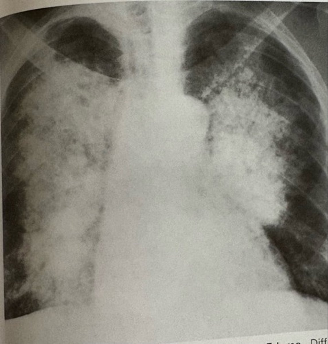 <p>what pathology is present?</p>