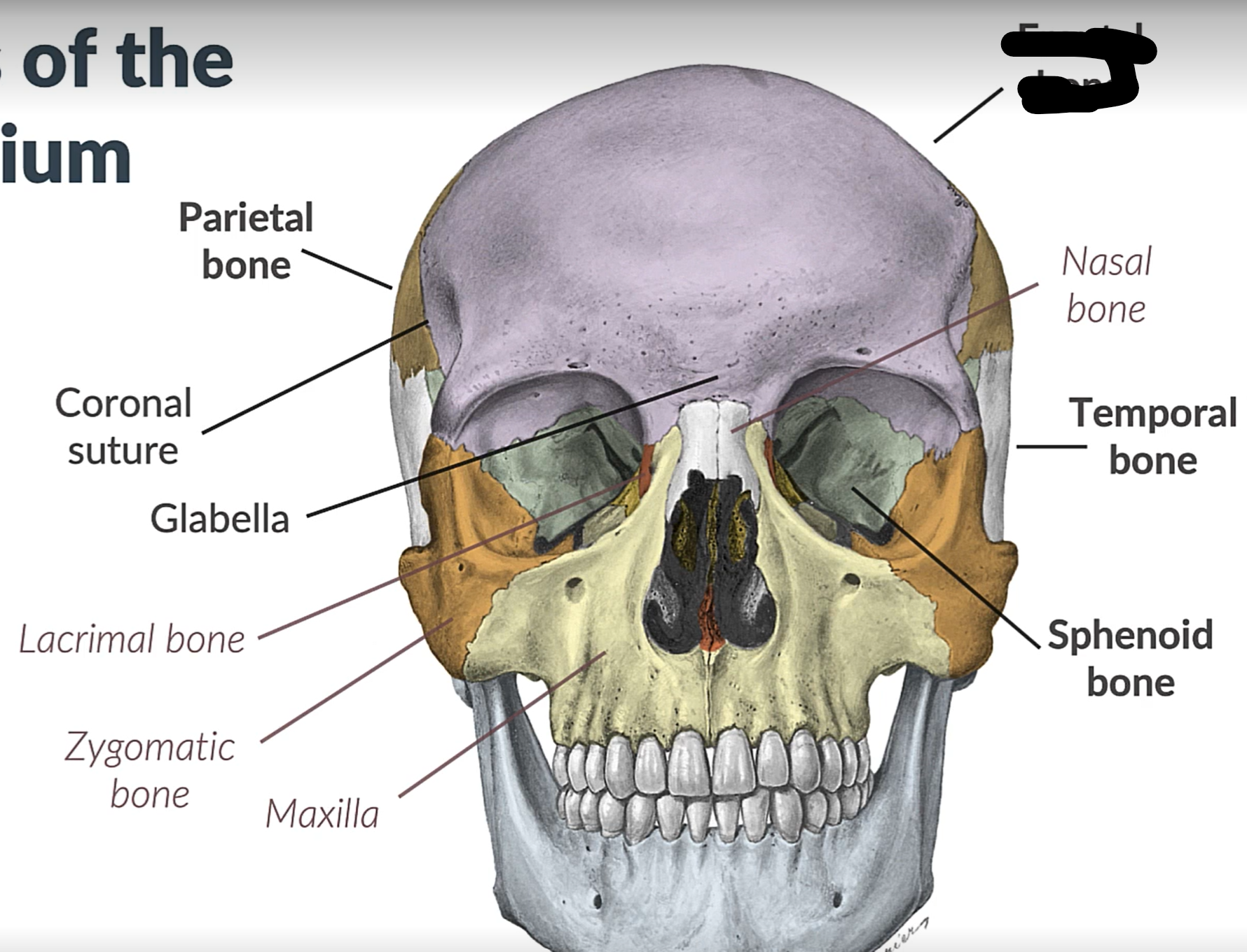 term image
