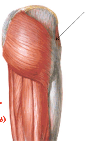 <p>What muscle is this?</p>