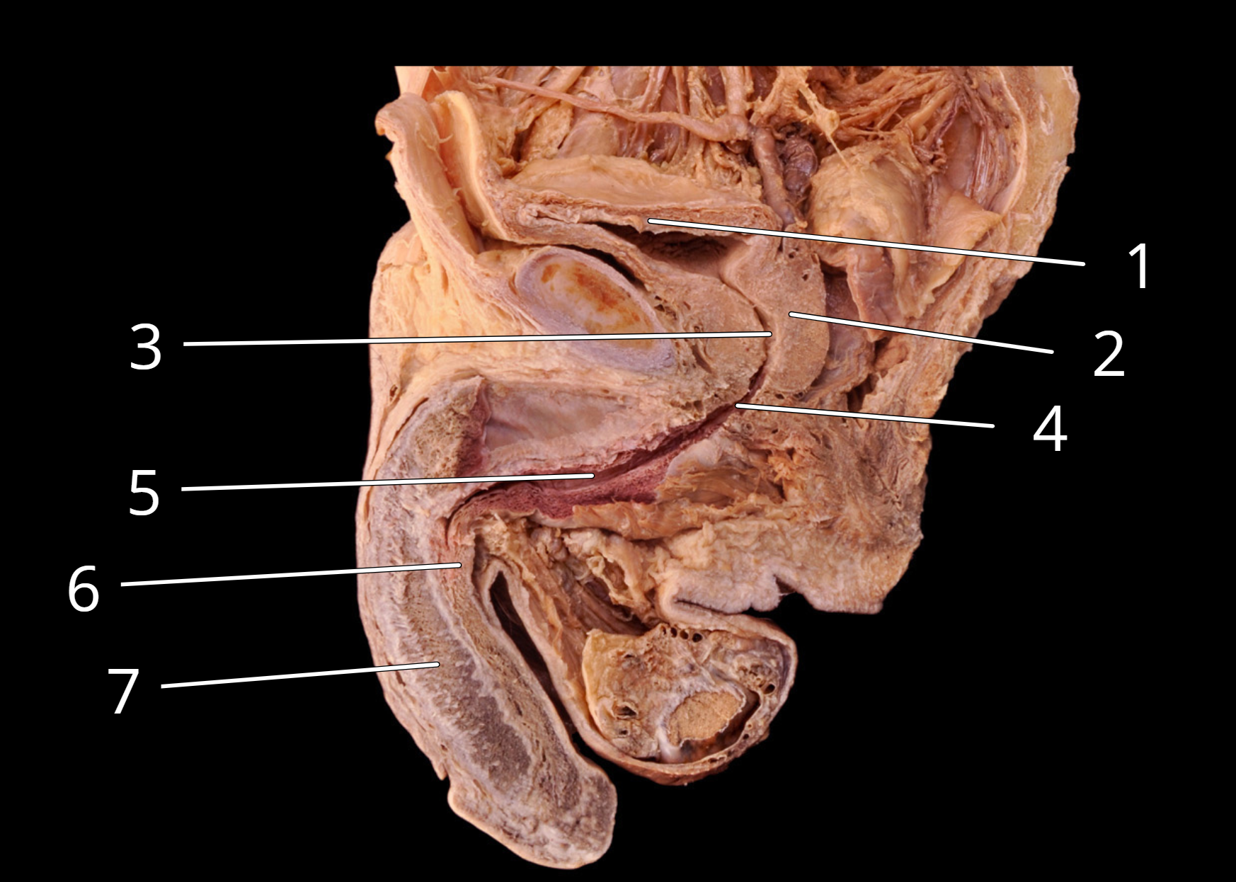 <p>Male reproductive structures,  sagittal view </p>