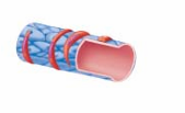 <p>Venules</p>