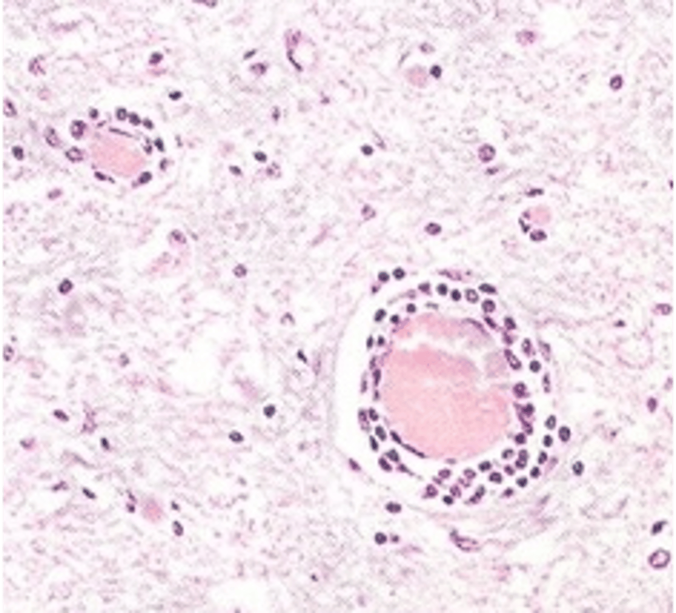 <p>what does this histology slide reveal</p>