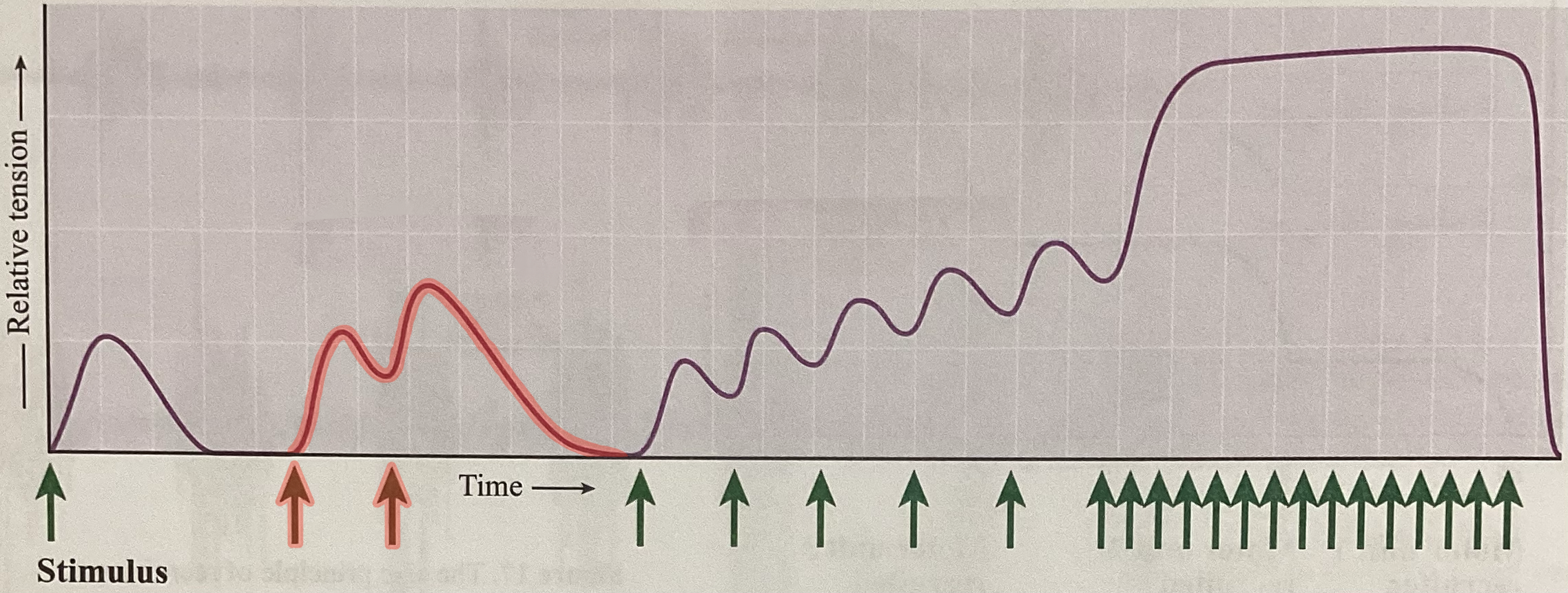 <p>What type of contraction is this?</p>