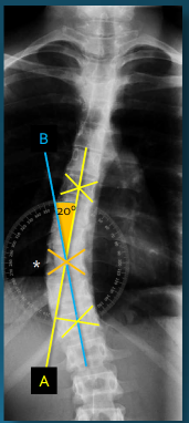 <p>Q what is the name of this measurement? and what is the average + range?</p>