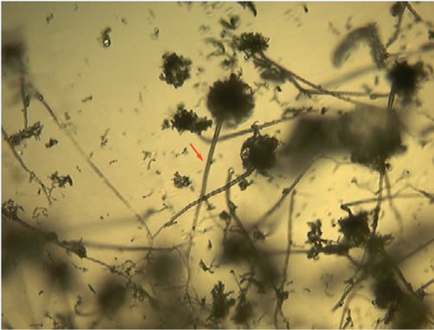 <p>d. Conidiophore</p>