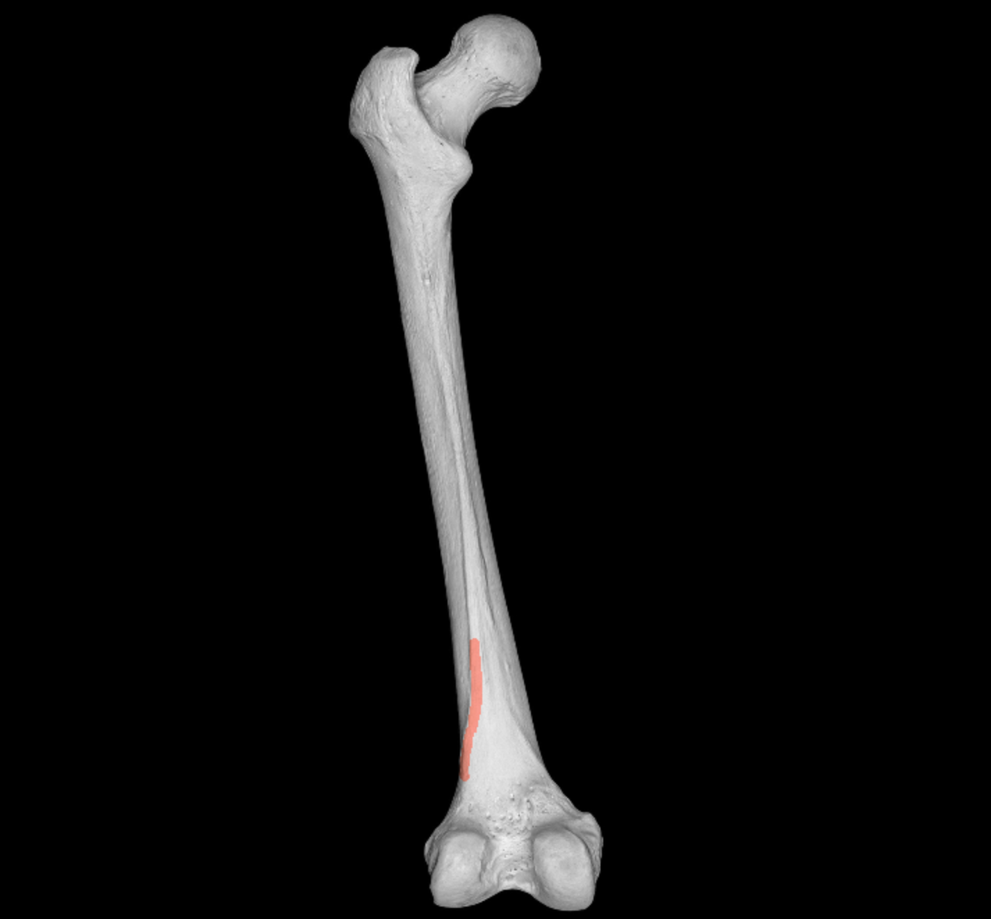 <p>lateral side of split from linea aspera of femur</p>