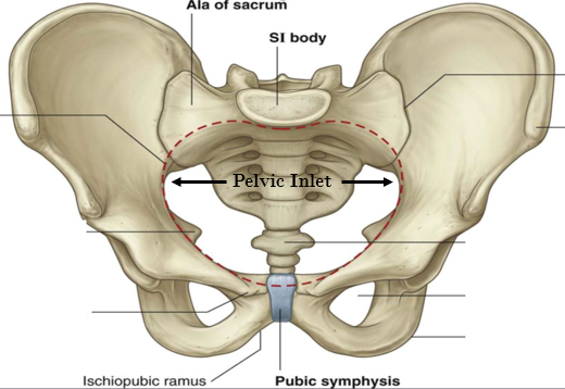 <p>Nutation causes a decrease in the pelvic inlet</p>