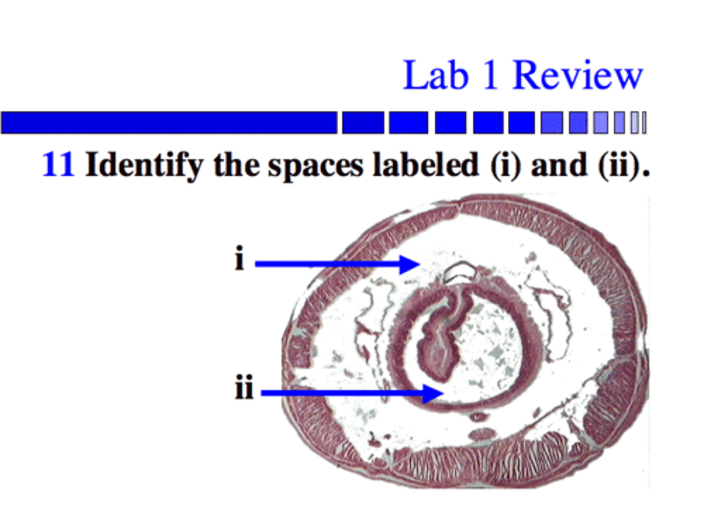 <p>Name the labels below of the Annelida (Lophotrochozoans) Oligochaetae (earthworm)</p>