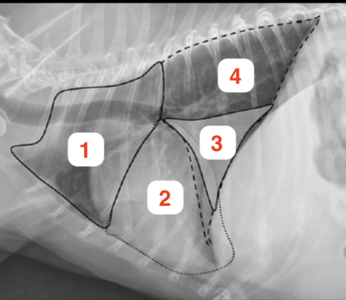 <p>Is this a left or right lateral image?</p>