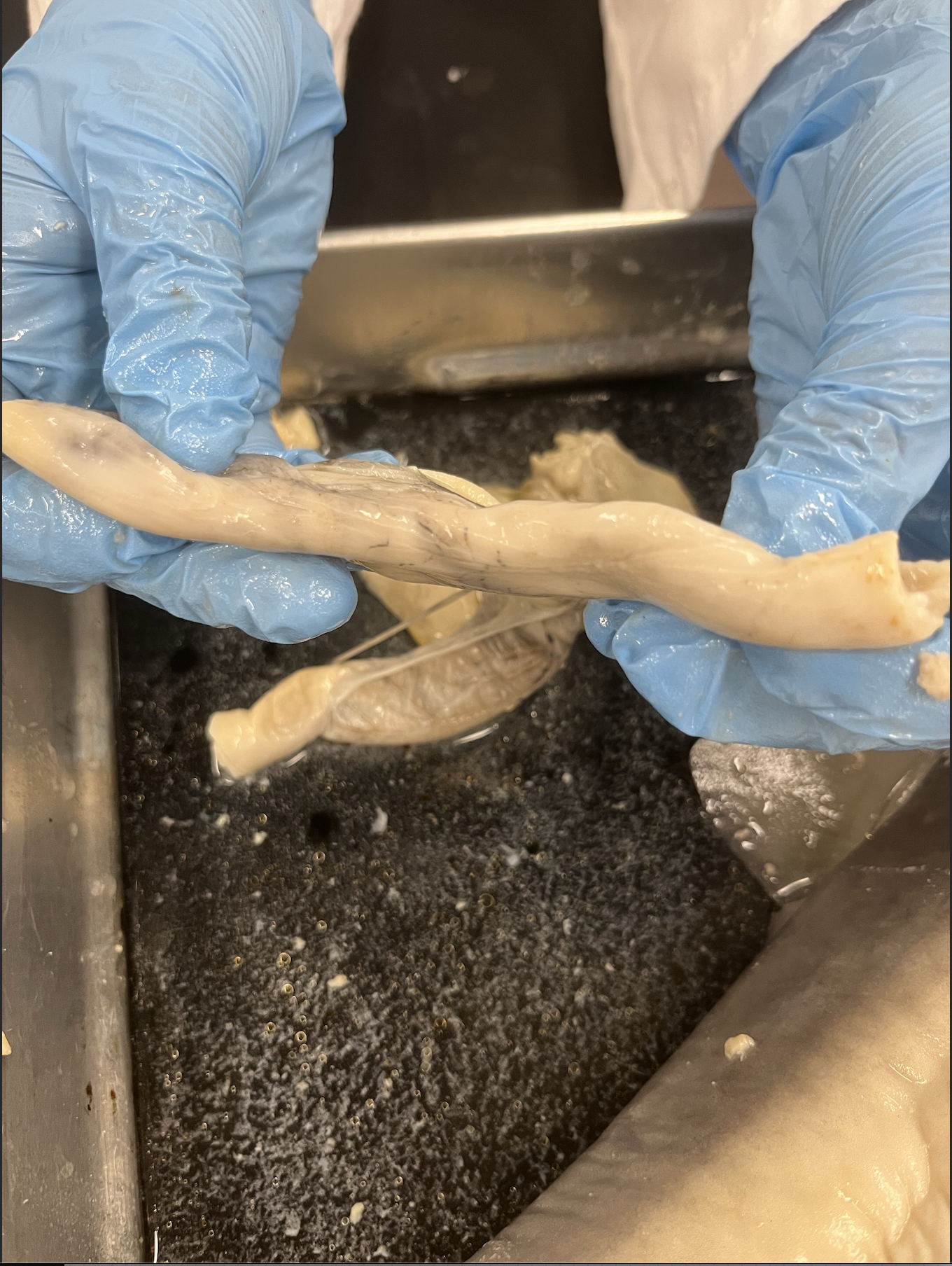<p>what specimen is this?</p><p>what is seen in the image?</p>