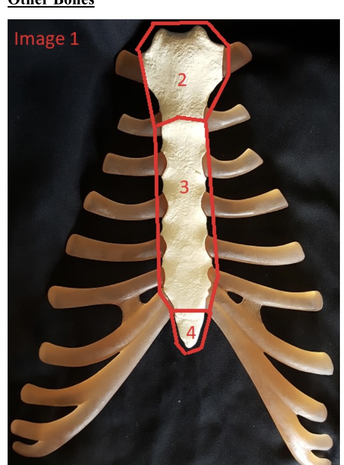 <p>2) name this bone</p>