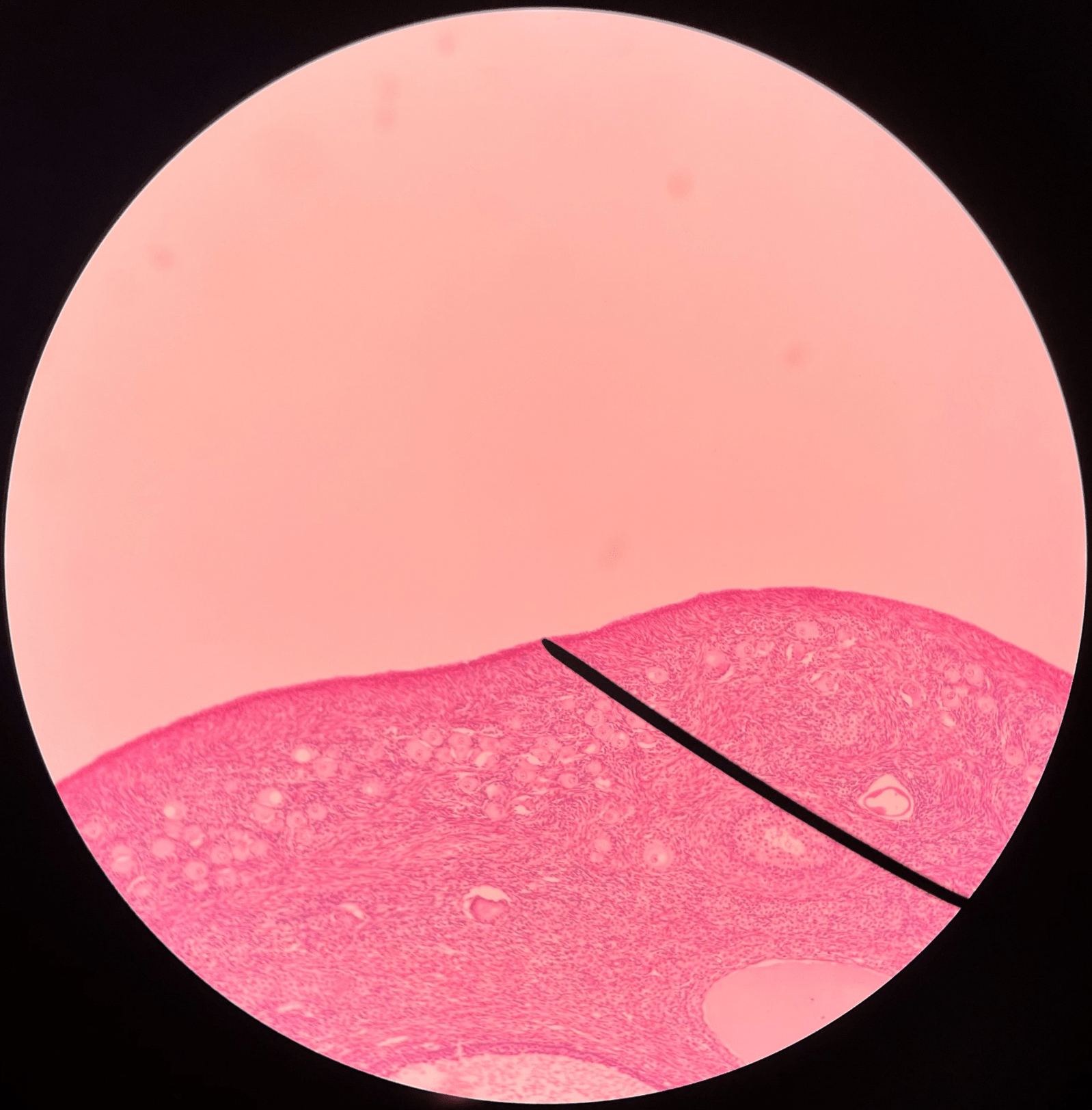 • Slide histology of the ovary.

• A layer of simple cuboidal epithelium externally covering the tunica albuginea.