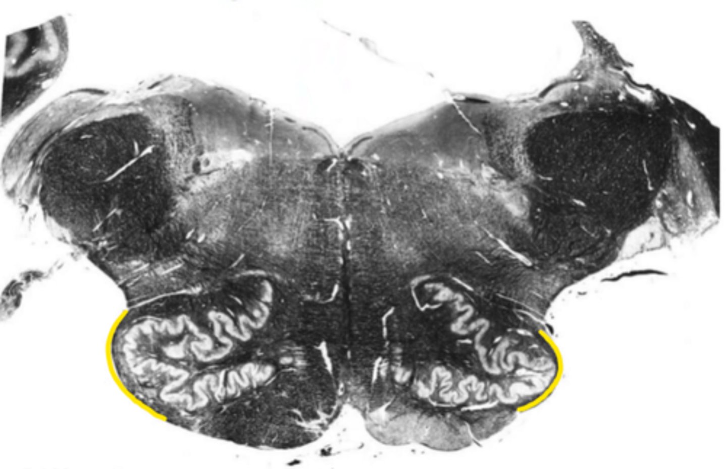 <p>ID the structure</p>