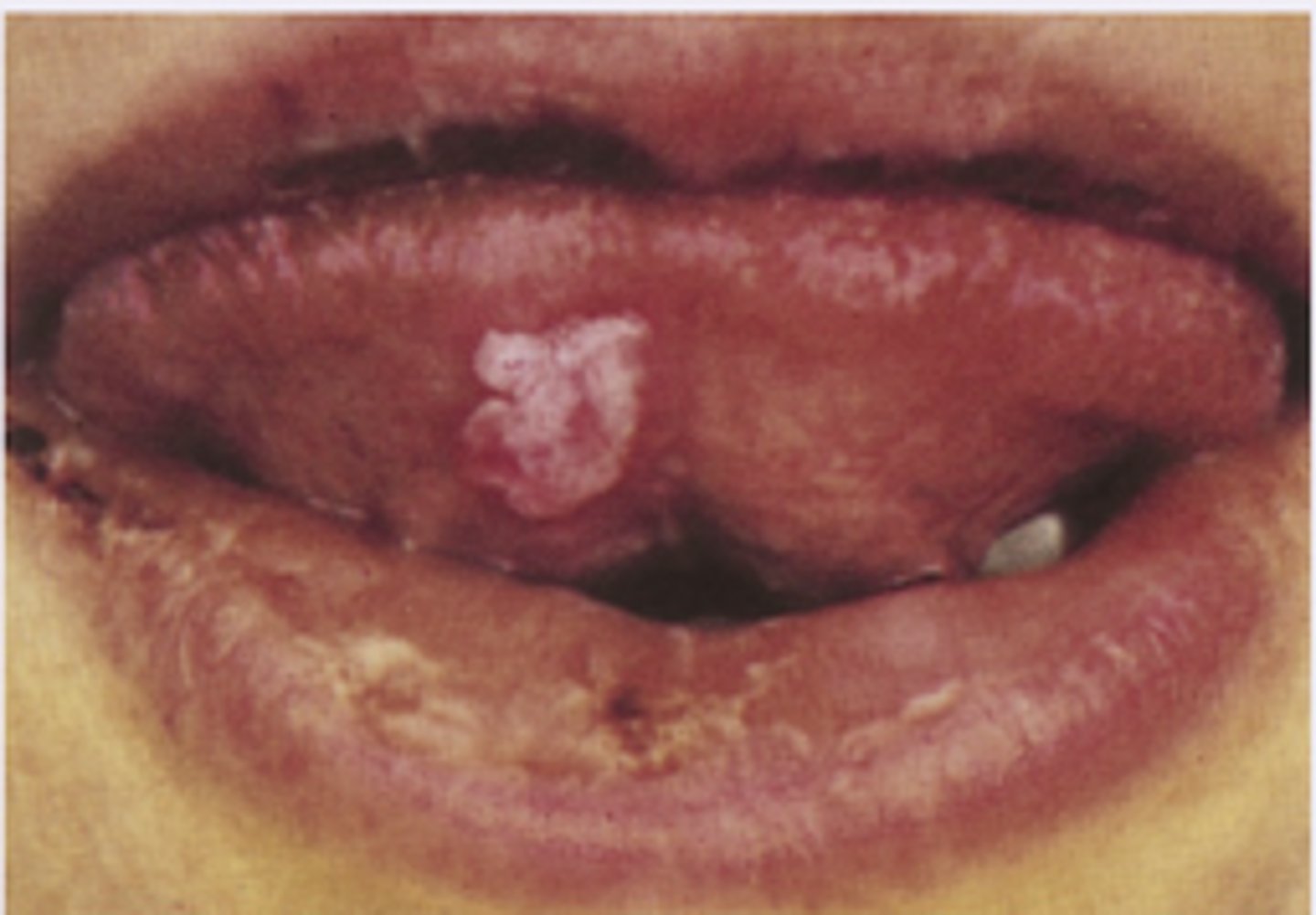 <p>Diagnosis?</p>